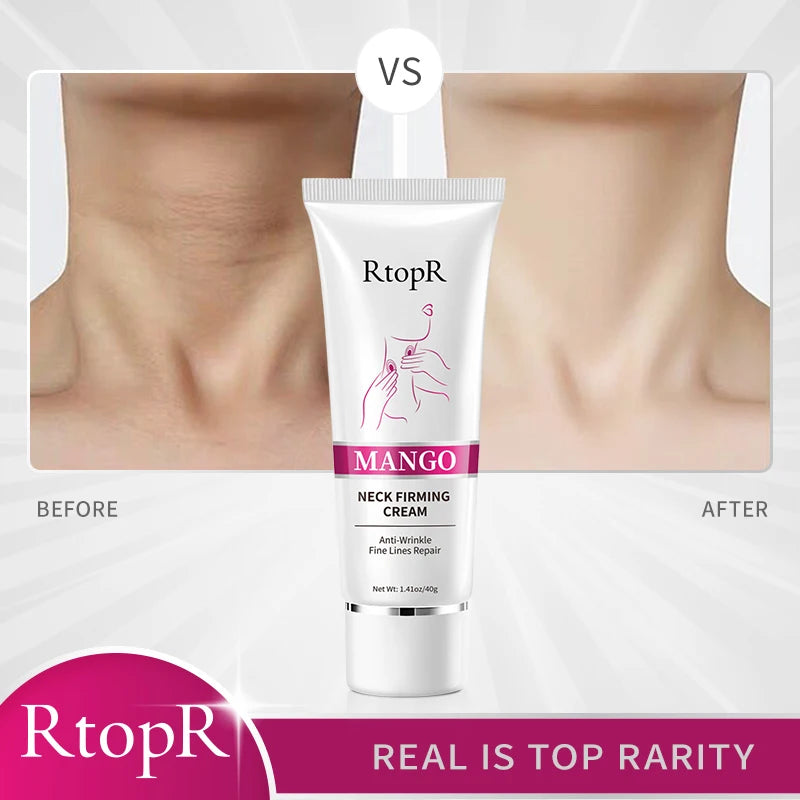 RtopR Neck Firming Cream