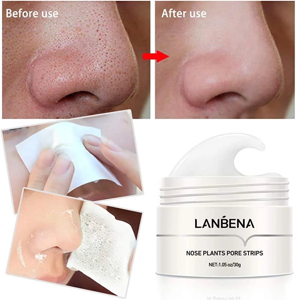 LANBENA Blackhead Remover