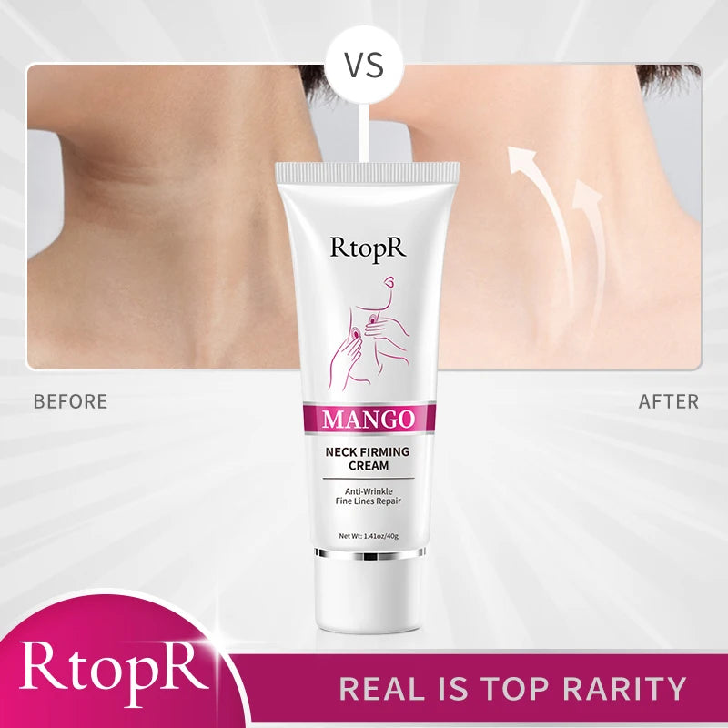 RtopR Neck Firming Cream