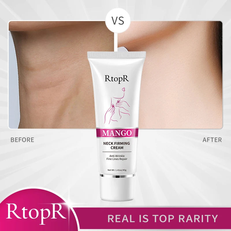 RtopR Neck Firming Cream