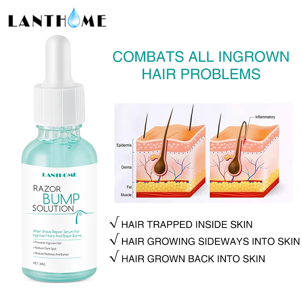 Lanthome - Body and Facial Hair Removal to Prevent Ingrown Hairs