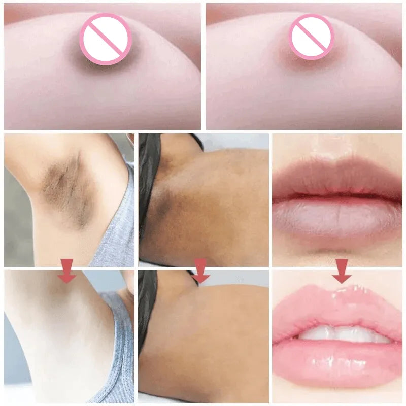 Private Parts Whitening Essence - Remove Melanin