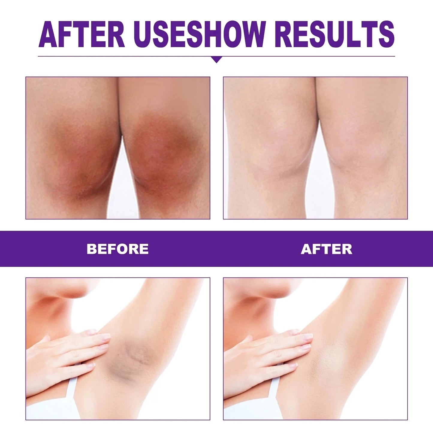 Sexy Pink - Private Whitening Cream: Armpit, Buttock, Nipple Pink Essence