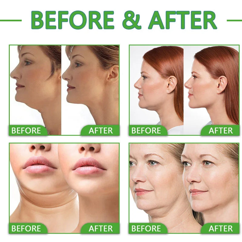 Collagen Neck Cream: Anti-Aging & Moisturizing