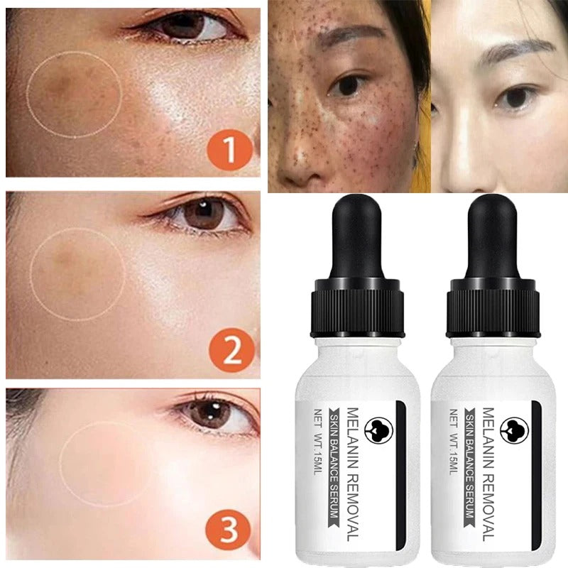 Niacinamide Serum: Dark Spot Removal & Skin Whitening