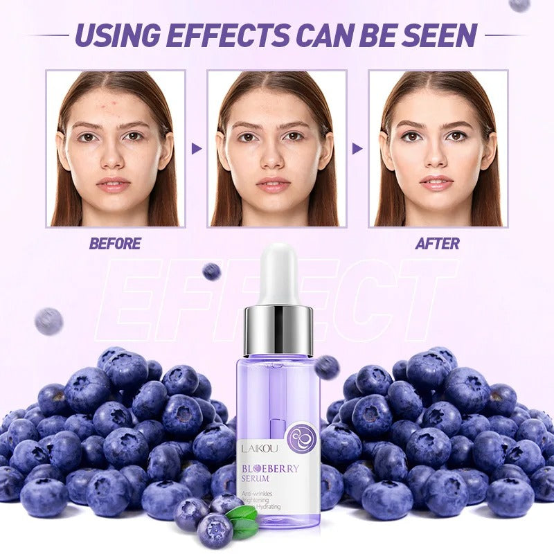 Blueberry Brightening Serum: Anti-Wrinkle & Moisturizing Care, 17ml