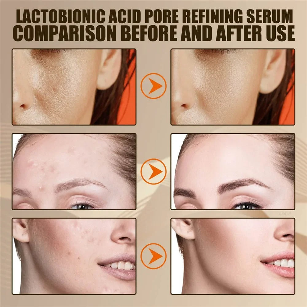 Lactobionic Pore Shrink Serum: Moisturizing Essence