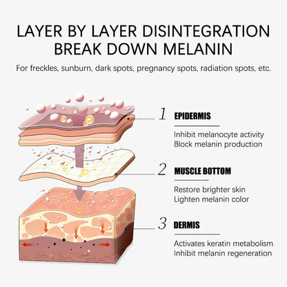 Whitening Freckles Cream for Melasma and Dark Spots