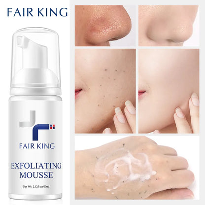 Foaming Exfoliating Mousse Face Wash for  All SkinTypes