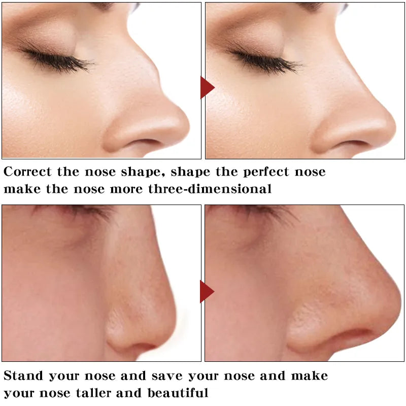 Nose Up Heighten Rhinoplasty oil