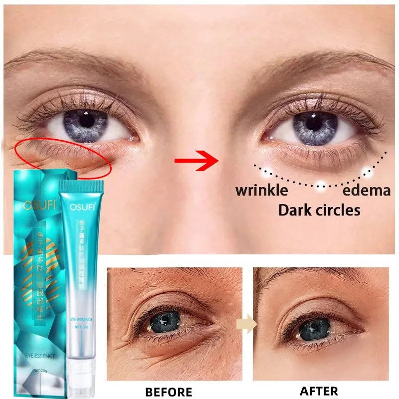 Eye Wrinkle Removal - Whitening Serum with Firming Moisturizing Eye