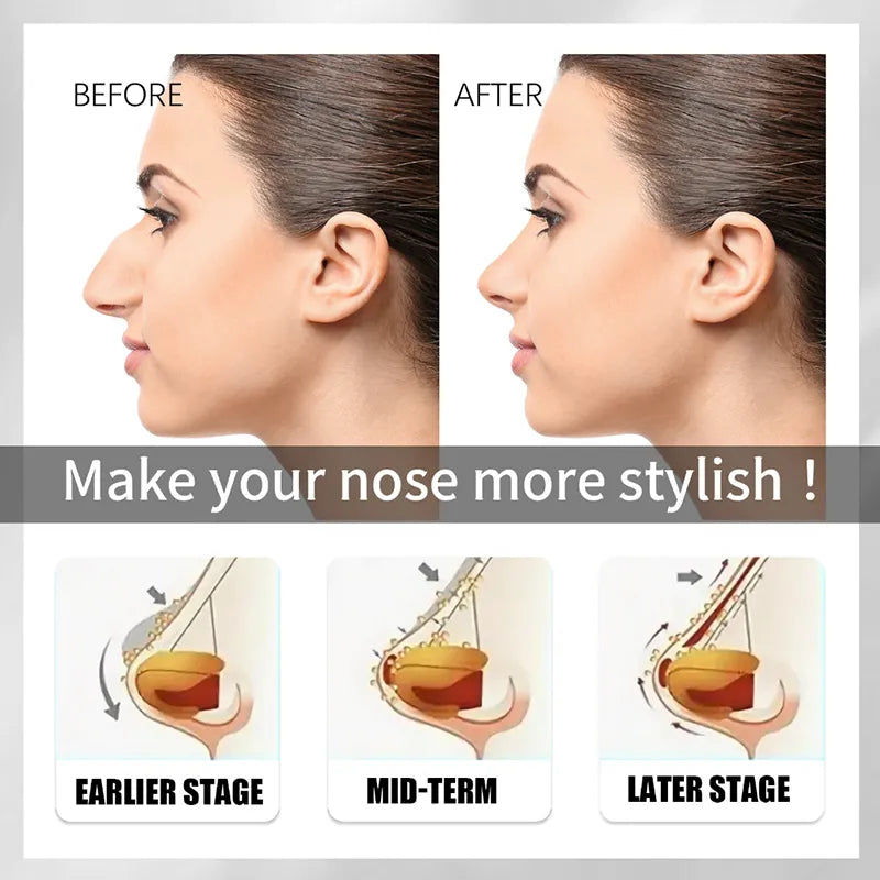 Nose Up Heighten Rhinoplasty oil