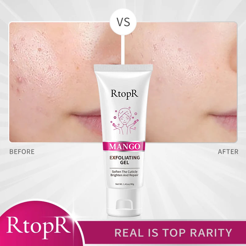 RtopR Exfoliating Gel and Cleanser