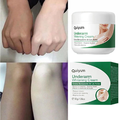 Effective Body Whitening Cream for Armpits, Legs, Knees, and Elbows