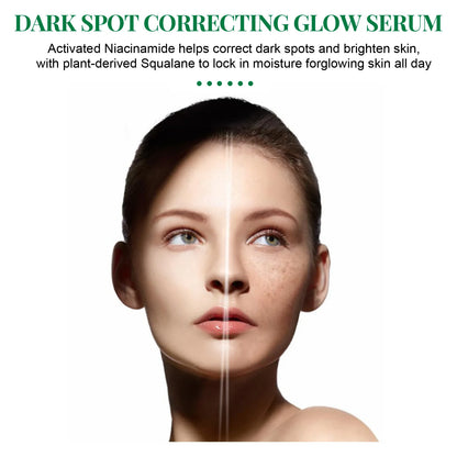 Dark Spot Removal Serum - Fade Pigmentation, Sun Spots Remover