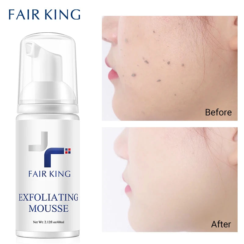 Fair King Exfoliating Facial Cleanser - Gentle Face Scrub for All Skin Types