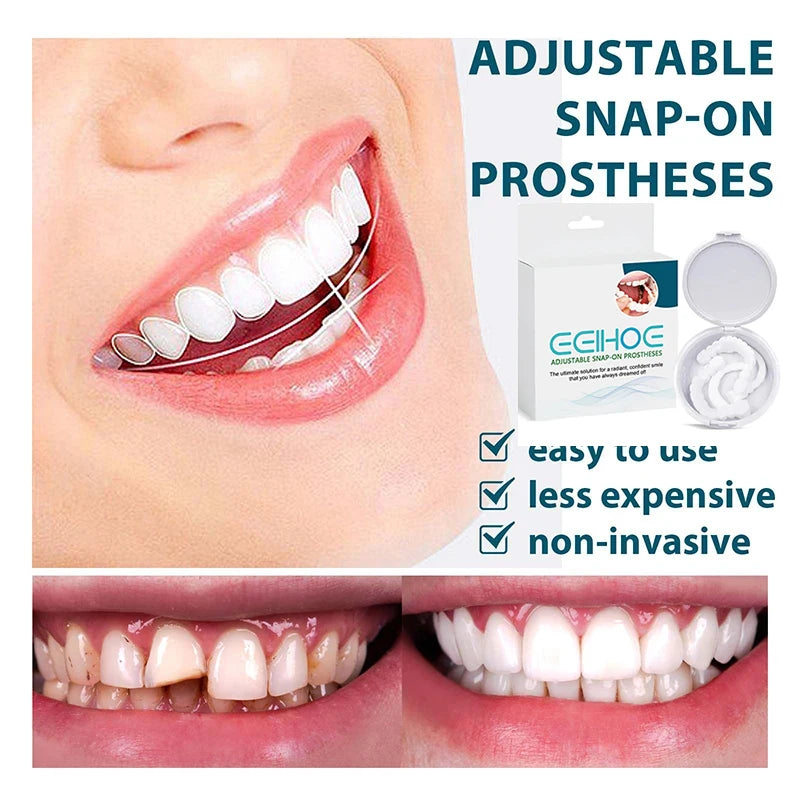 Adjustable Instant Smiling Veneer Denture - Whitening, Natural, Portable Teeth Set