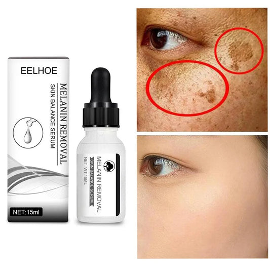 Niacinamide Serum: Dark Spot Removal & Skin Whitening