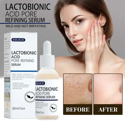 EELHOE Lactobionic Acid Pore Serum: Skin Repair & Blackhead Removal